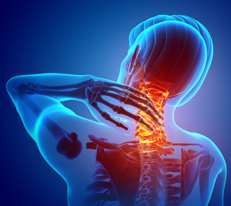 picture of neck pain